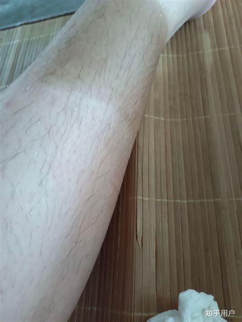 腿 毛 會 越 刮 越 粗 嗎